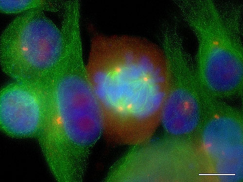 Fluorescence microscopy image showing a ternary metaphase in NZM12